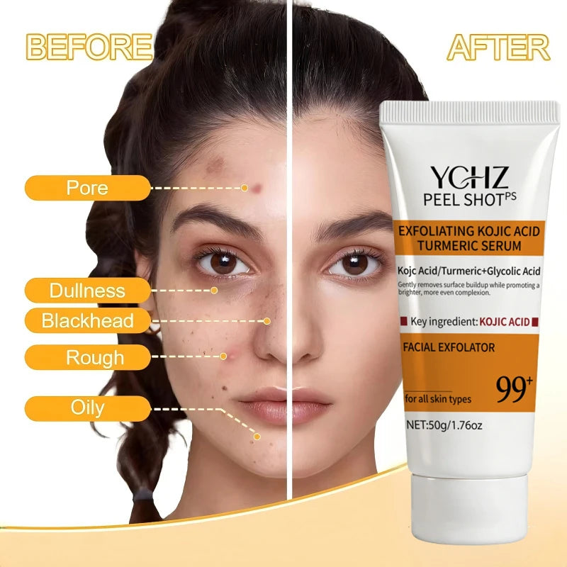 Turmeric Kojic Acid Exfoliating Gel Essence Suitable for Face and Body Gentle Orange Scented Facial Scrub Body Cleansing Gel Removes Dead Skin Scrub Skin Cleanser-50G