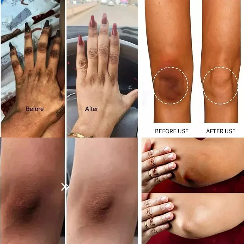 Collagen Underarm Whitening Cream for Dark Skin, Bleaching Underarm Intimate Area Skincare Products