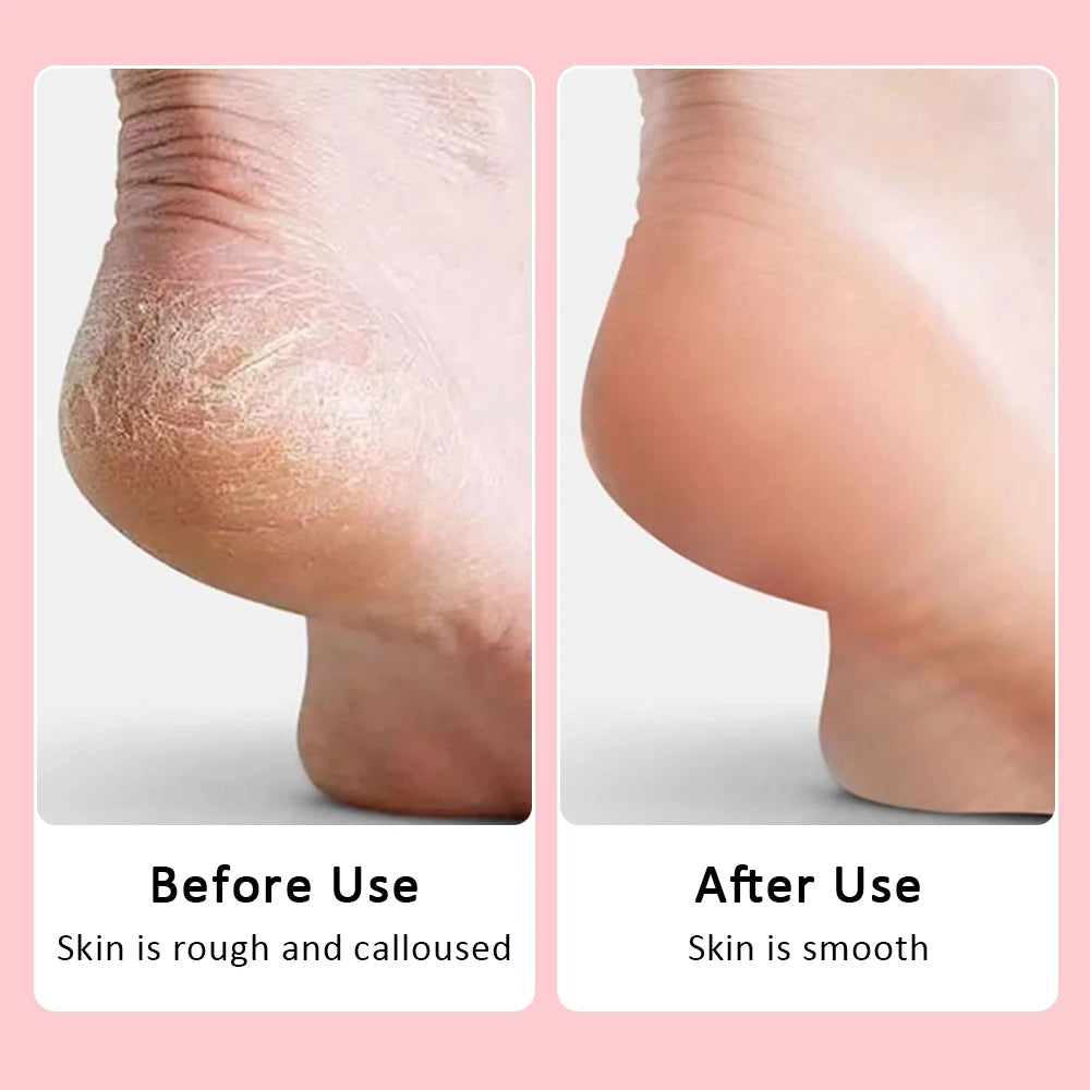 USB Rechargeable Wireless Electric Foot File Cuticle Callus Remover Machine Pedicure Tools Foot Heel Care Tool With Sandpaper
