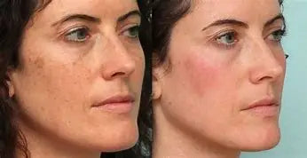 Retinol Whitening And Spot Removing Cream Softens Fine Lines & Wrinkles Repairs Skin Barriers Moisturizing And Brightening Face