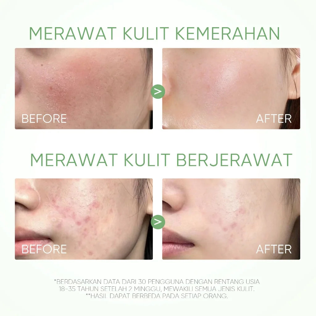 Mugwort Clay Stick Anti-Acne Clay Mask for Clean Pores and Blackheads Improve Acne Prone Skin 40g