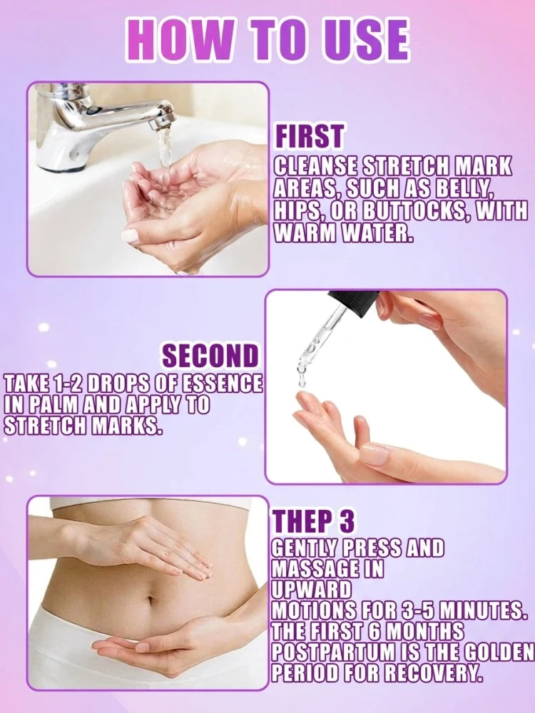 Intensive Stretch Mark Corrector Body Oil for Pregnancy & Post-Baby, C-Section Scar Fader & Anti-Sagging Firming Therapy