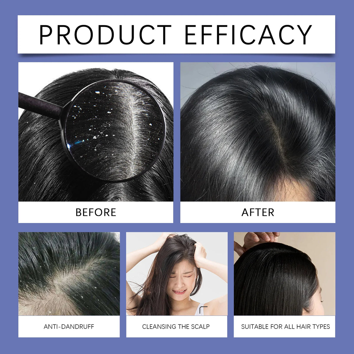 120ml Selenium Sulfide Shampoo Deep Cleansing Remove Dandruff Itchy Balance Oil Nourishing Restoration Hair Color Shampoo