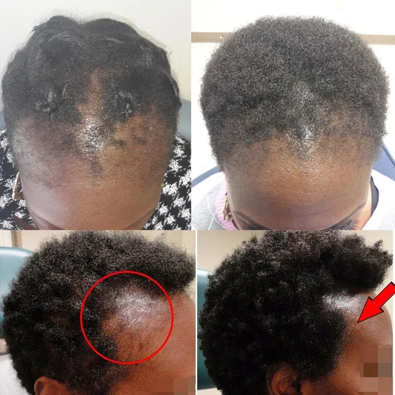 Fast Ginger Hair Growth Cream Anti Hair Loss Baldness Repair Damaged Scalp Treatment Nourish Hair Root Care Products Women Men