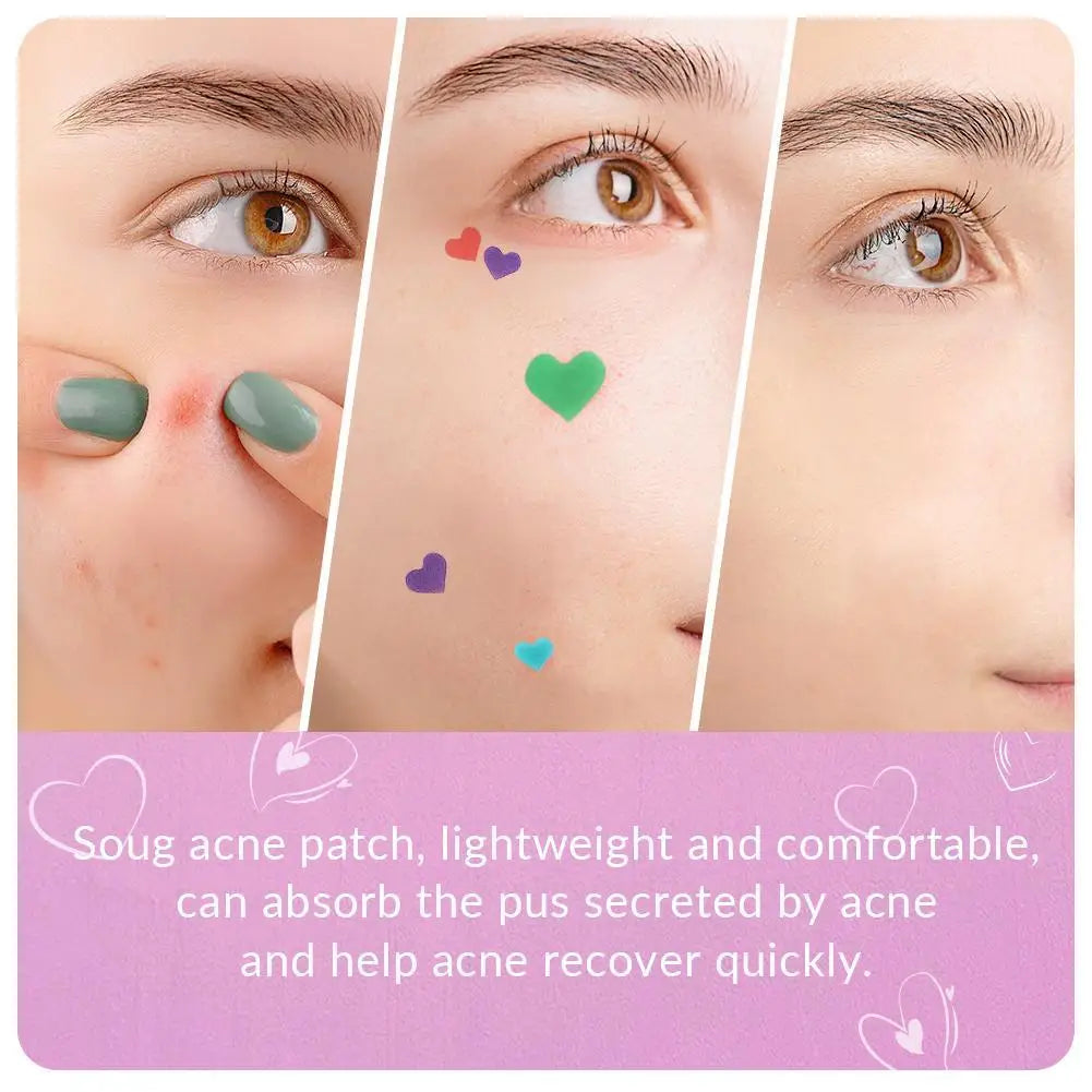 Butterfly Shape Acne Pimple Patch Stickers Blemish Spot Concealer Cover 0.1mm Acne Repair Pimple Remover Skin Care