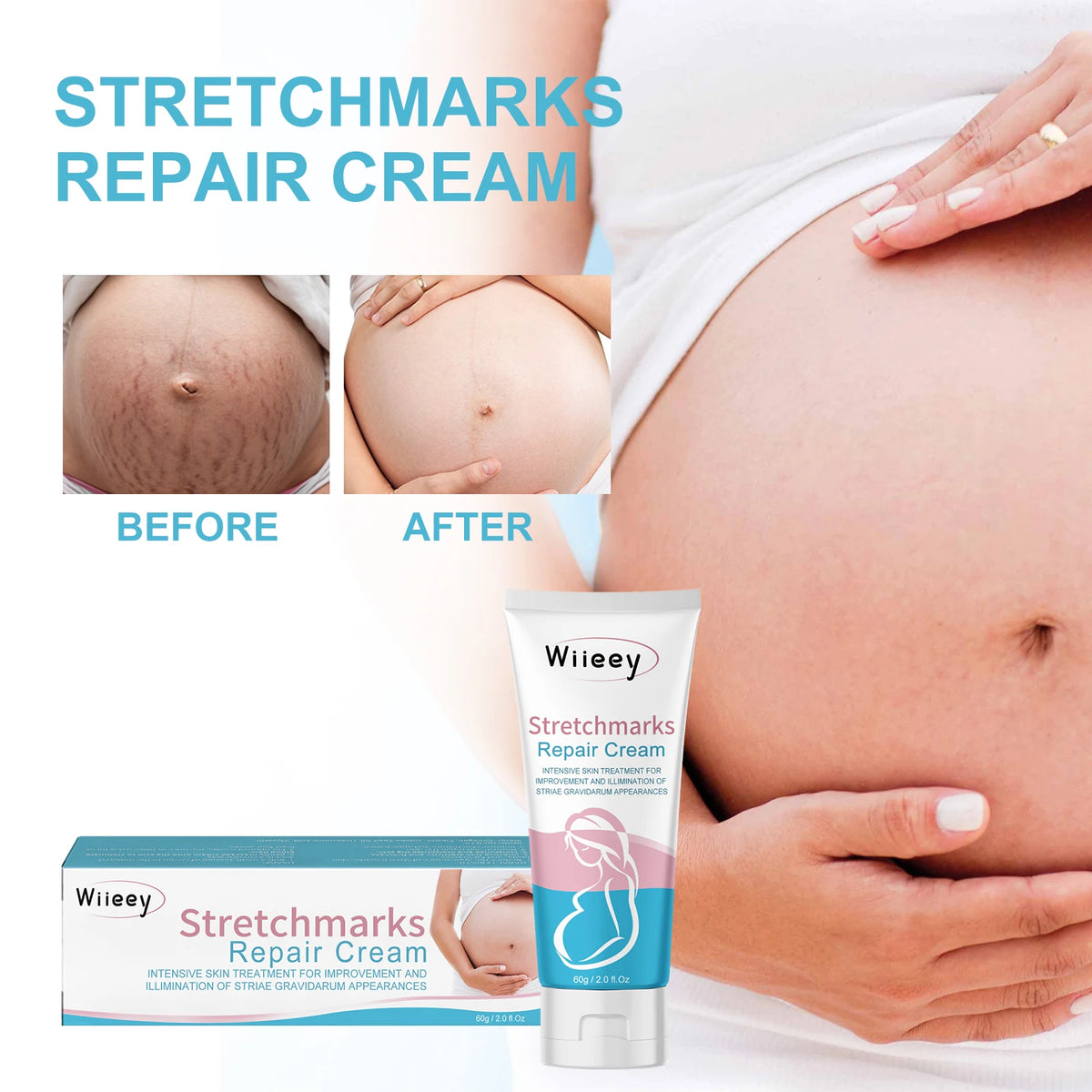 Stretchmarks Repair Cream Remove Pregnancy Firm Skin Enhance Elasticity Body Cream Nourish Moisturizing Pregnant Women Skin Care
