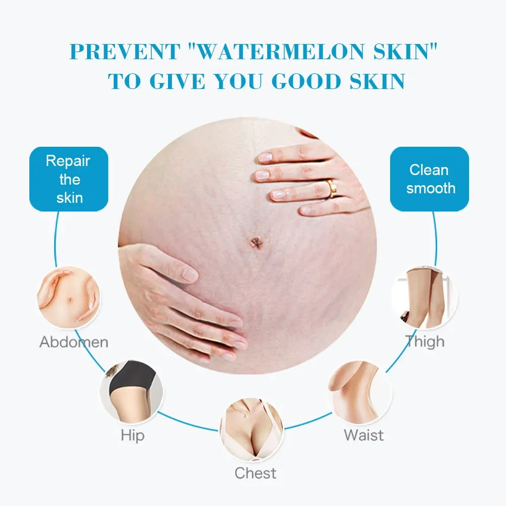 Snail Removes Stretch Mark Cream To Remove Postpartum Obesity Pregnant Women Repair Anti-Aging Anti-Winkles Firming Body Cream