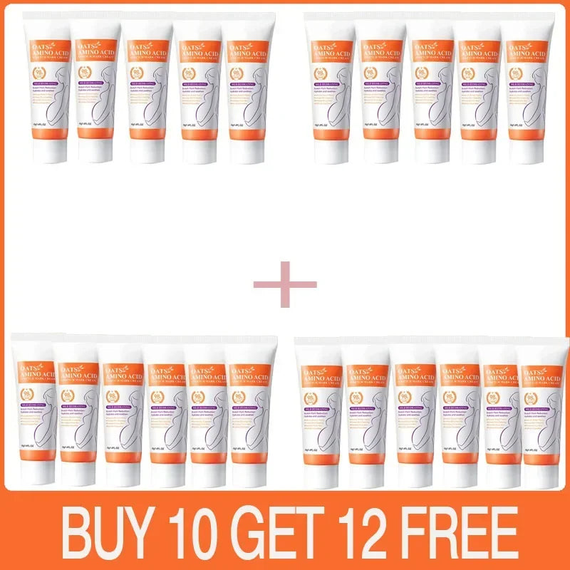 Powerful Stretch Marks Remover Pregnancy Cream Light Lines Removal Postpartum Obesity