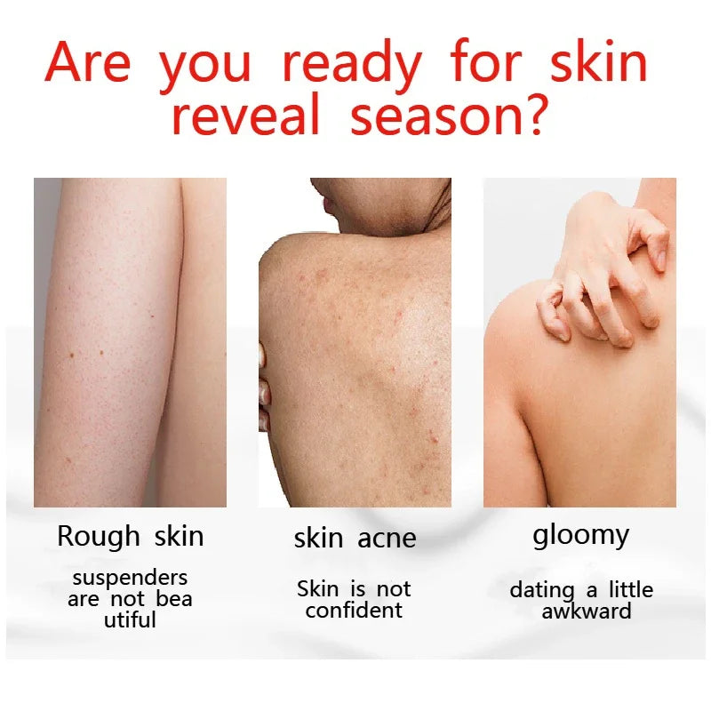 Whitening Shower Gel Women Body Wash Men's Oil Bath Cleansers Bath Beauty Health Cleaning Dirt  Inhibiting Melanin Body Works