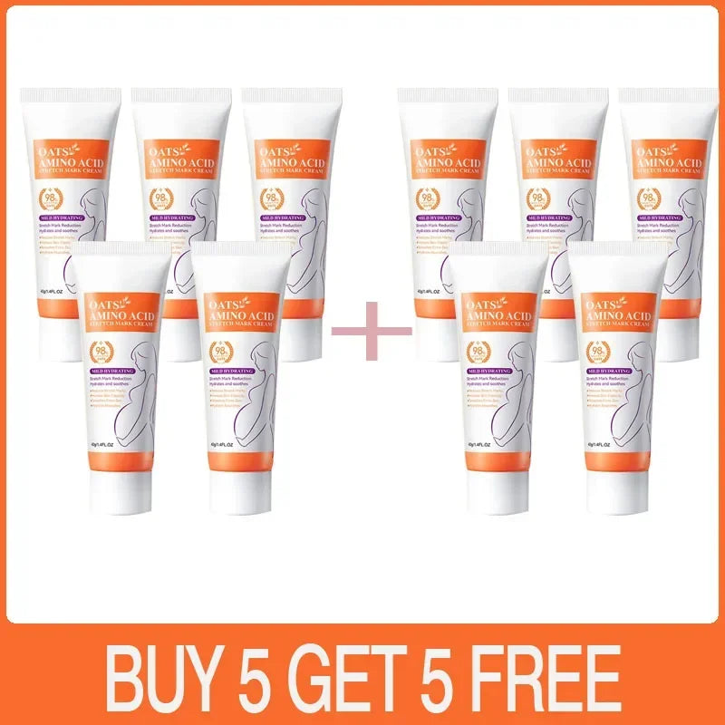 Powerful Stretch Marks Remover Pregnancy Cream Light Lines Removal Postpartum Obesity