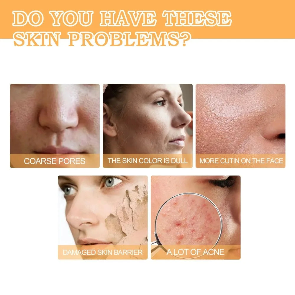 Glycolic Acid 7% Toning Solution Acne Remover Face Skincare Firming Moisturize Glycolic Acid Gentle Tone Exfoliating Toner 1/2pc
