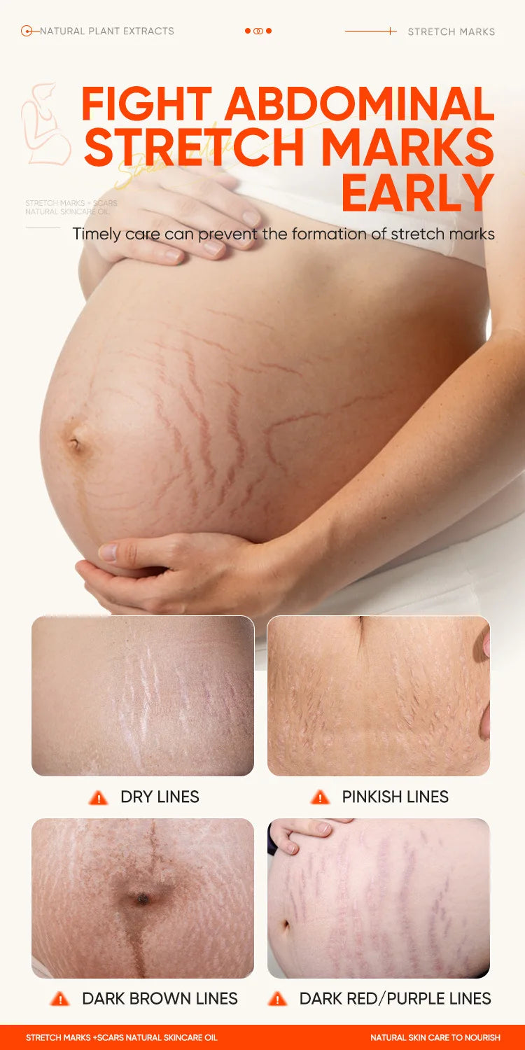 150ml Vitamin E Skin Care Oil Remove Pregnancy Stretch Marks Postpartum Care Elastic Skin Firming Collagen Body Care Oil