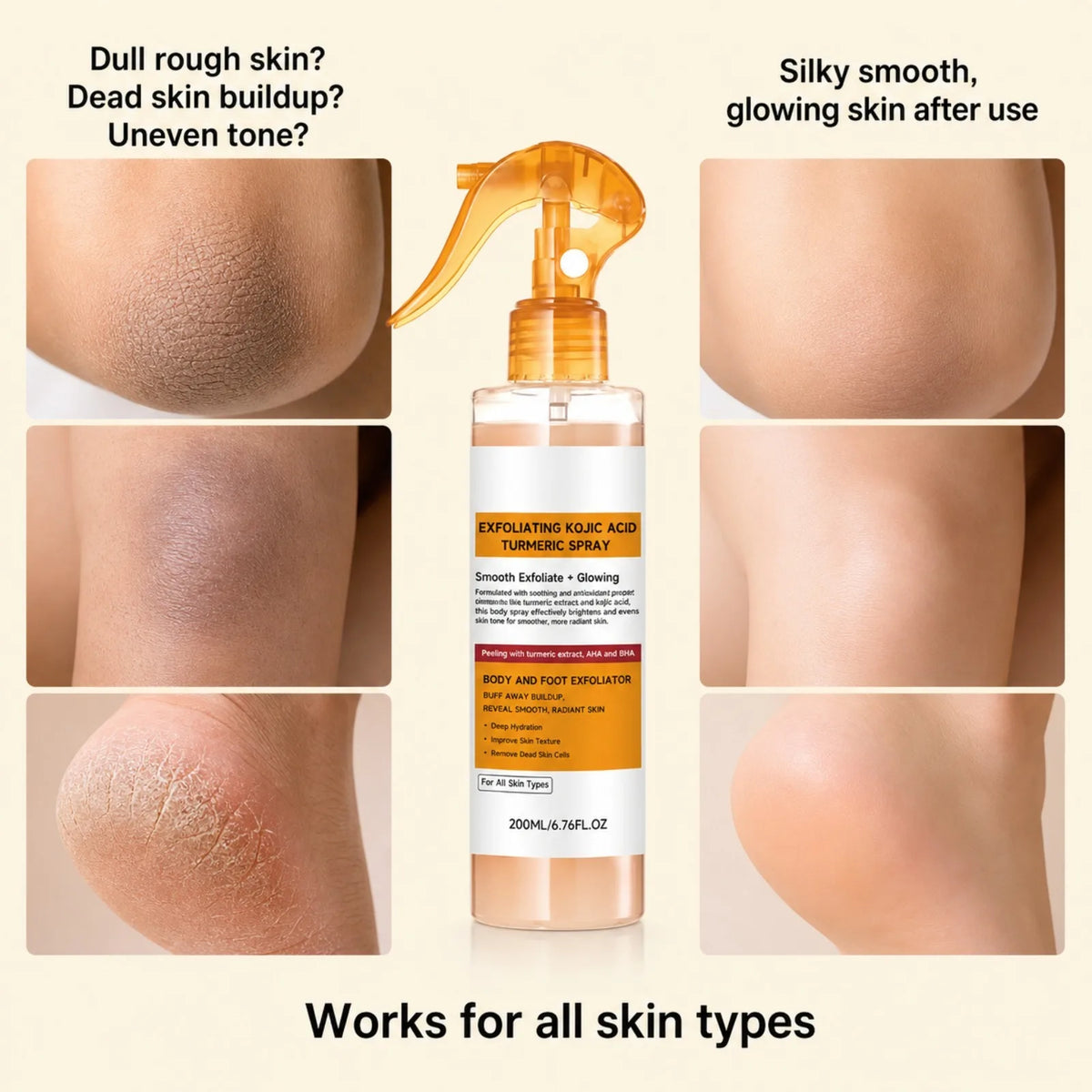 Exfoliating Kojic Acid Turmeric Spray and Serum Skin Care Set Gentle Exfoliation Improve Dull Tone Smooth Brightening Kit