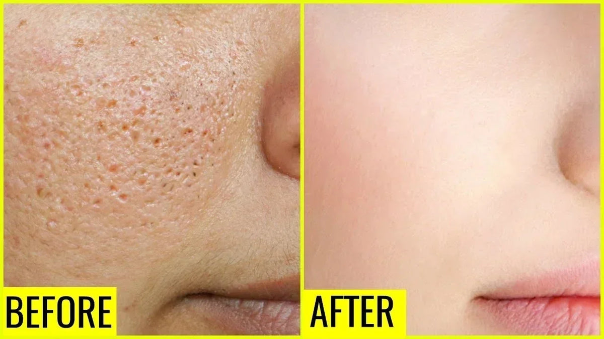 Pore Shrink Face Serum Remove Blackheads Acne Acidity Oil Control Repair Essence Moisturizing Nourish Pores Firming Facial Care