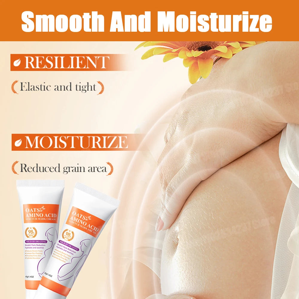 Powerful Stretch Marks Remover Pregnancy Cream Light Lines Removal Postpartum Obesity