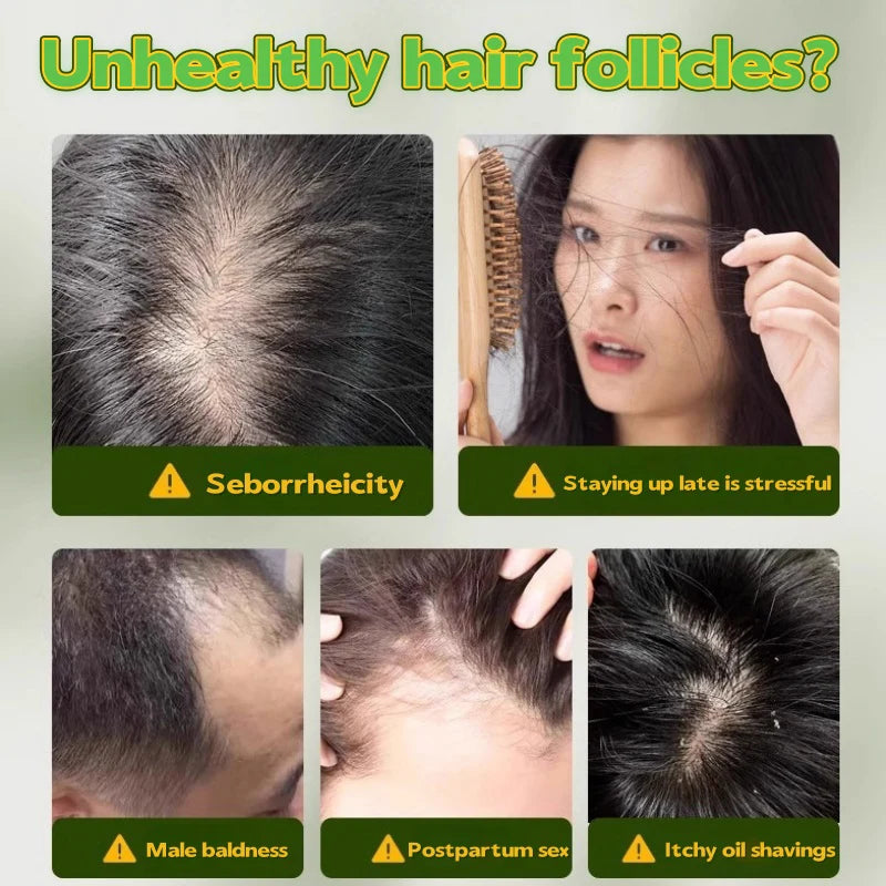 Usman Grass Platycladus Herbal Shampoo Soap Natural Hair Loss Treat Strengthens Roots Controls Oil Cleanses Scalp Hair Growth