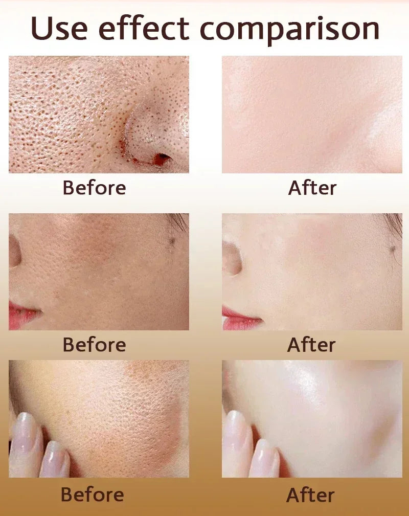 Pore Shrink Face Serum Remove Blackheads Acne Acidity Oil Control Repair Essence Moisturizing Nourish Pores Firming Facial Care