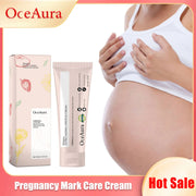 Stretch Mark Cream Postpartum Treatment Improves Firming Effective Removes Growth Lines Obesity Women Pregnant Mark Care Lotion