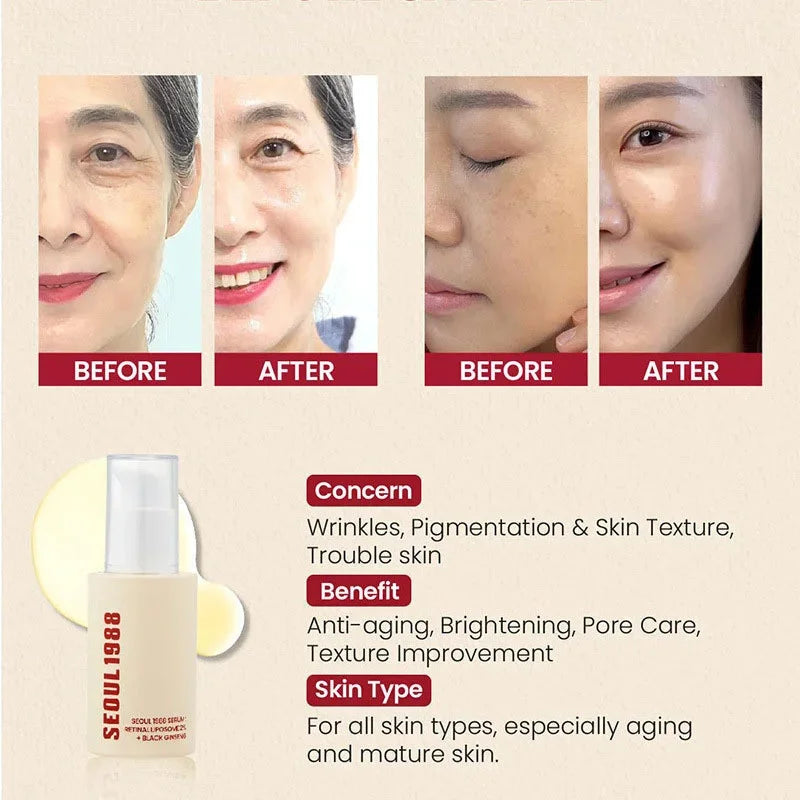 Korean 1988 Retinol Face Care Serum Black Ginseng Niacinamide 2% Acid Moisturizing Firming Cream Anti Aging Wrinkle Skin Care