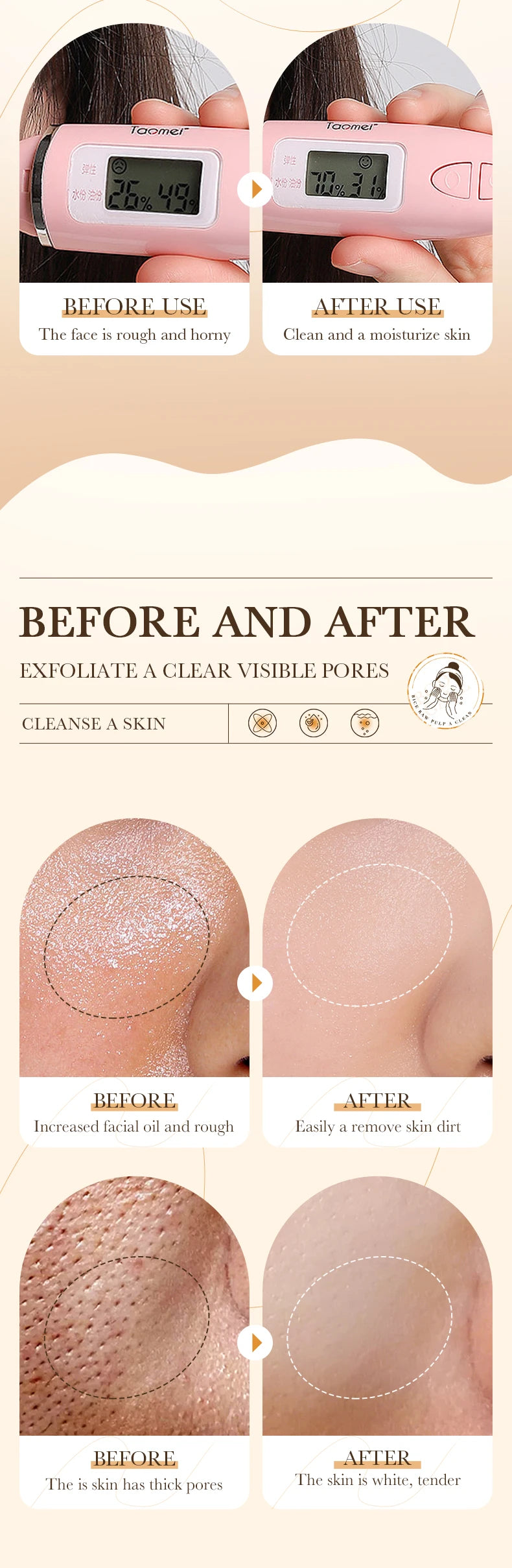 120ml BIOAOUA rice puree cleansing mousse, mild moisturizing, oil-controlling, pore-cleansing, exfoliating facial cleanser