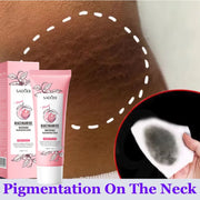 Whitening Body Cream For Dark Skin Armpit Thigh Inner Joint Fade Intimate Area Underarm Body Care Private Part Brighten Lotion