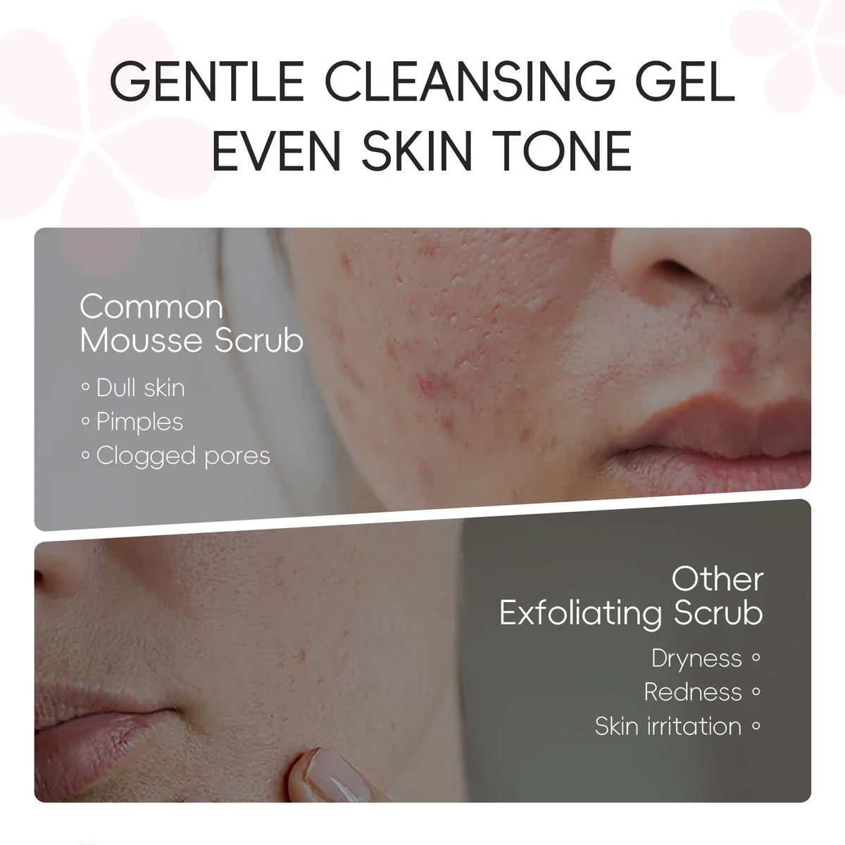 LAIKOU  Sakura Peeling Gel, Deep Cleansing Face Exfoliator, Remove Dead Skin Smooth Skin Gentle Exfoliating Scrub 60g
