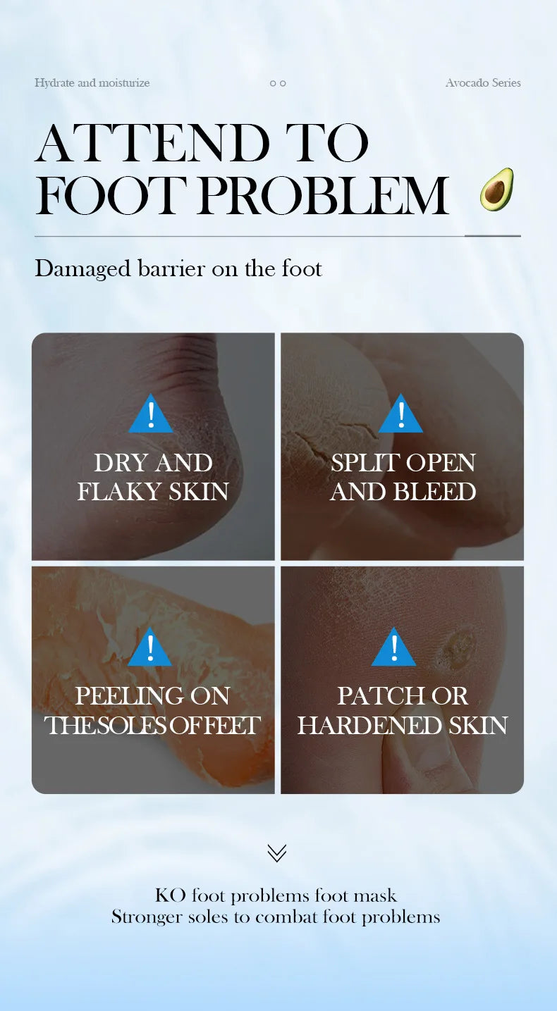 5 Pairs Avocado Exfoliating Foot Mask Feet Pedicure Remove Dead Skin Moisturizing Foot Exfoliator Feet Masks Skin Care Products