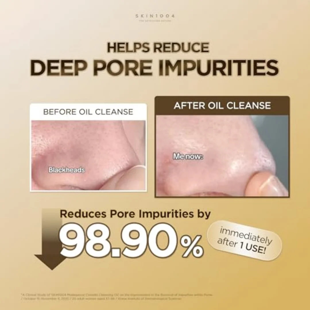 SKIN1004 Madagascar Centella Light Cleansing Oil Korean Facial Cleanser Gentle NO Irritating Double Cleansing Oil Makeup Remover