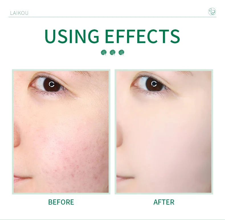 LAlKOU Japan Sakura Gentle Cleansing Facial Cleanser Shrink Pores Deep Clean Oil Control Remove Blackhead Moisturizing Skin Care