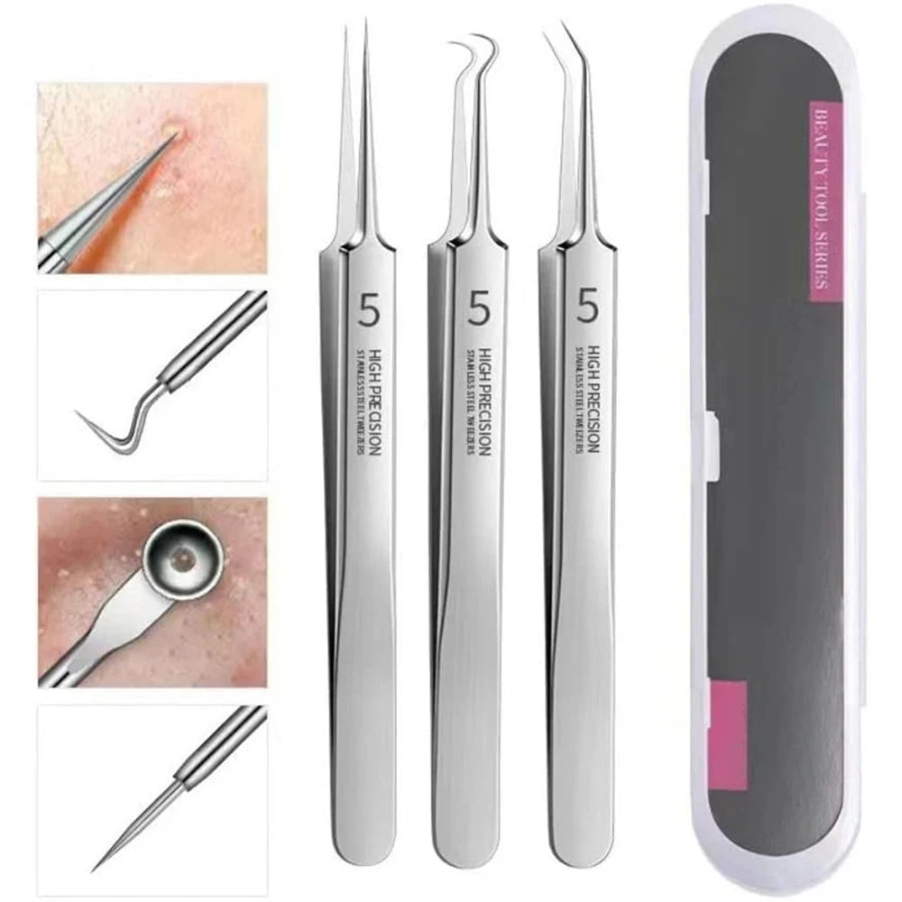 Stainless Steel Tweezers, Facial Blackhead Remover Set - 3-Piece Set With Storage Box, Ultra-Sharp, Cleans Facial Pores