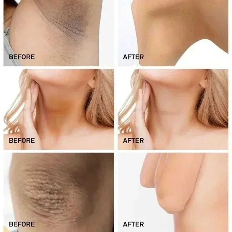 Collagen Underarm Whitening Cream for Dark Skin, Bleaching Underarm Intimate Area Skincare Products