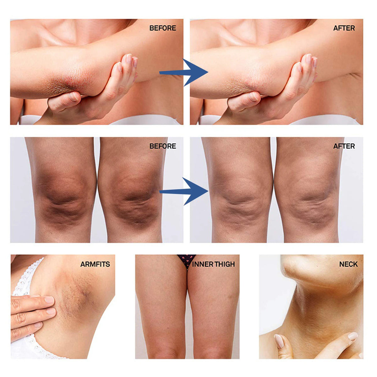 Whitening Cream To Private Area Armpits Bikini Zone Reduce Dark Spots Improve Luster Brighten Skin Moisturizing Body Care Lotion