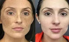 Retinol Whitening And Spot Removing Cream Softens Fine Lines & Wrinkles Repairs Skin Barriers Moisturizing And Brightening Face