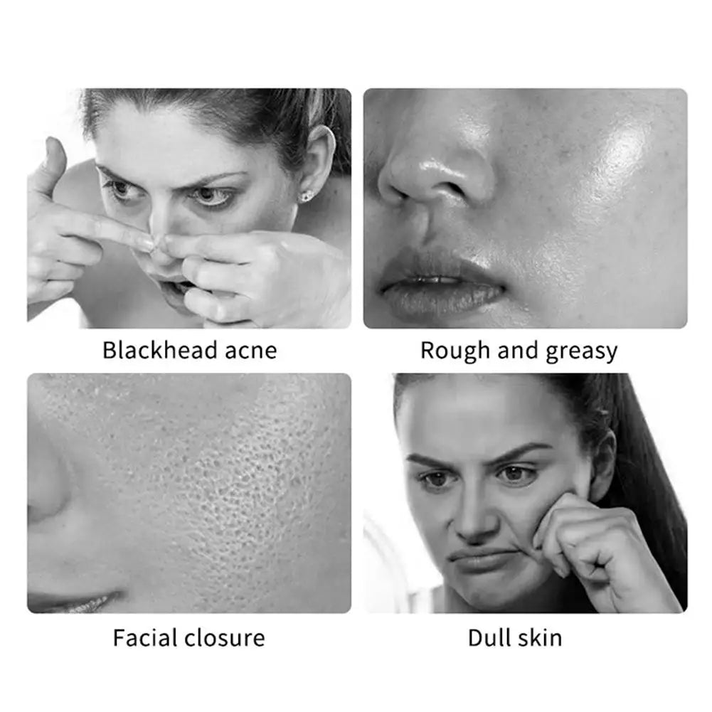 Herbal Exfoliating Gel for Deep Skin Cleansing Exfoliating, Moisturizes and Brightens Complexion Facial Care 50g 1pcs
