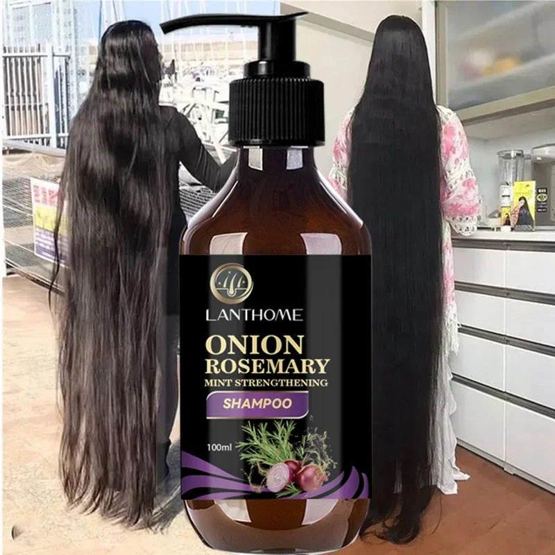 100ML Hair Shampoo For Fast Hair Growth Rosemary Onion Shampoo 30ML Spray Anti Hair Loss Effective Within 7 Day Hair Growth